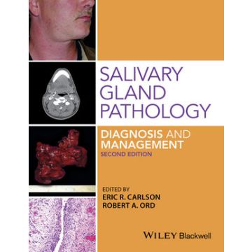 Salivary Gland Pathology: Diagnosis and Management, 2ed.  Carlson Eric; Ord Robert A.  Wiley - Blackwell  9781118933756