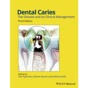 Dental Caries: The Disease and its Clinical Management, 3ed.  Fejerskov Ole; Nyvad Bente; Kidd Edwina  Wiley - Blackwell  9781118935828