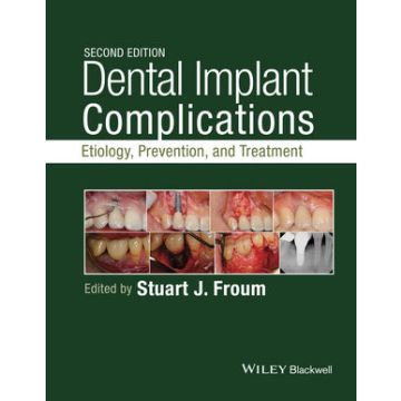 Dental Implant Complications: Etiology, Prevention, and Treatment, 2ed.  Froum Stuart J.  Wiley - Blackwell  9781118976456