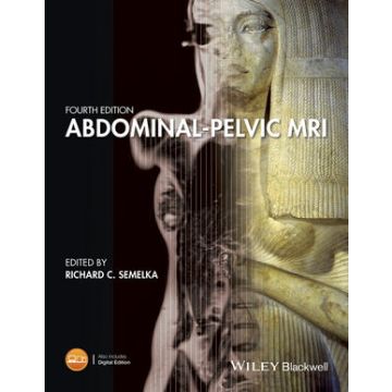 Abdominal-Pelvic MRI, 4ed.  Semelka Richard C.; Brown Michele A.; Altun Ersan  Wiley - Blackwell  9781119012931