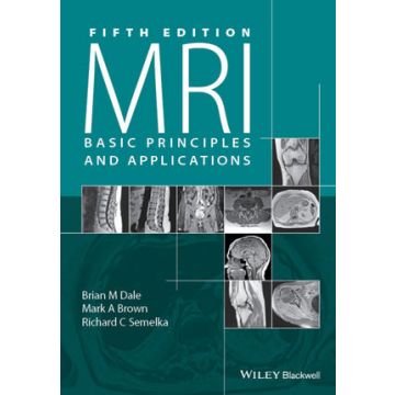 MRI: Basic Principles and Applications, 5ed.  Dale Brian M.; Brown Mark A.; Semelka Richard C.  Wiley - Blackwell  9781119013051