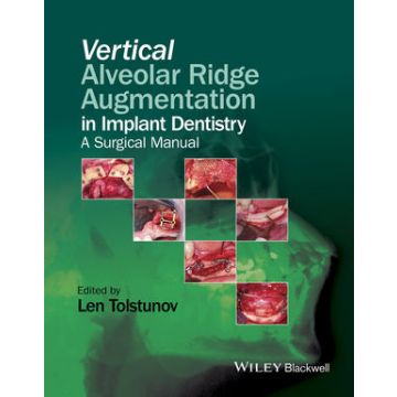 Vertical Augmentation of the Alveolar Ridge in Implant Dentistry  Tolstunov Len  Wiley - Blackwell  9781119082590