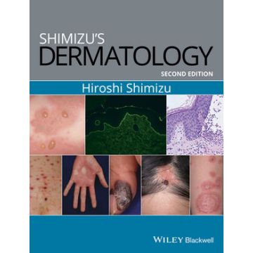 Shimizu's Dermatology, 2ed.  Shimizu Hiroshi  Wiley - Blackwell  9781119099055