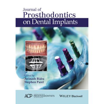 Journal of Prosthodontics on Dental Implants  Bidra Avinash S.; Parel Stephen M.  Wiley - Blackwell  9781119115366