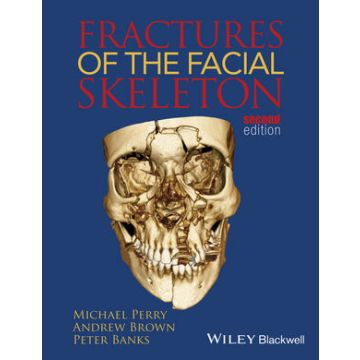 Fractures of the Facial Skeleton, 2ed.  Perry Michael; Brown Andrew; Banks Peter  Wiley - Blackwell  9781119967668