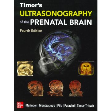 Ultrasonography of the prenatal & neonatal brain. Nuova ediz.