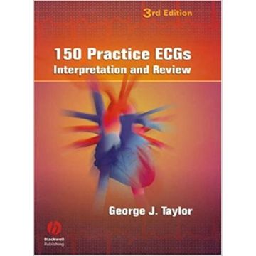 150 practice ECGs Interpretation and Review
