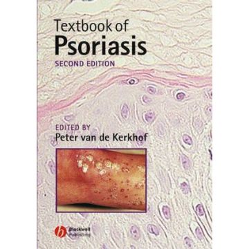 Textbook of Psoriasis, 2ed.  Van de Kerkhof Peter C. M.  Wiley - Blackwell  9781405107174