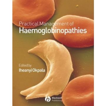 Practical Management of Haemoglobinopathies  Okpala Iheanyi  Wiley - Blackwell  9781405107808