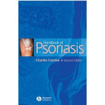 Handbook of Psoriasis, 2ed.  Camisa Charles  Wiley - Blackwell  9781405109277