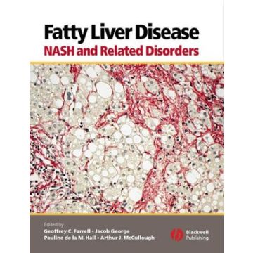Fatty Liver Disease: NASH and Related Disorders  Farrell Geoffrey C.; George Jacob; Hall Pauline de la M.; McCullough Arthur J.  Wiley - Blackwell  9781405112925