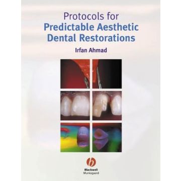 Protocols for Predictable Aesthetic Dental Restorations  Ahmad Irfan  Wiley - Blackwell  9781405118200