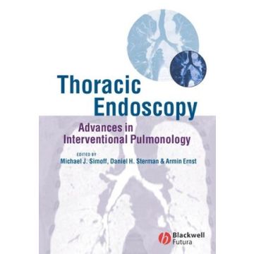 Thoracic Endoscopy: Advances in Interventional Pulmonology  Simoff Michael J.; Sterman Daniel H.; Ernst Armin  Wiley - Blackwell  9781405122047