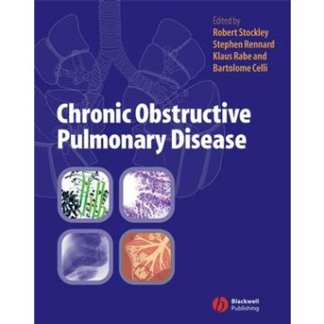 Chronic Obstructive Pulmonary Disease: A Practical Guide to Management  Stockley Robert A.; Rennard Stephen; Rabe Klaus; Celli Bartolome  Wiley - Blackwell  9781405122894