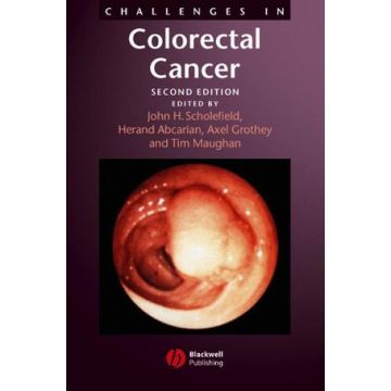 Challenges in Colorectal Cancer, 2ed.  Scholefield John; Abcarian Herand; Maughan Tim; rothey Axel  Wiley - Blackwell  9781405127066