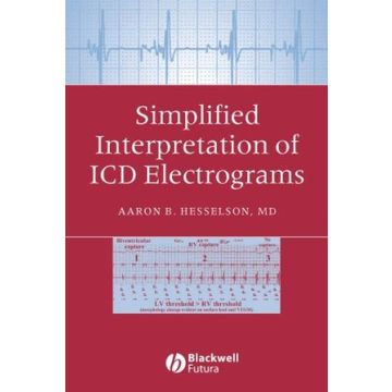 Simplified Interpretation of ICD Electrograms  Hesselson Aaron B.  Wiley - Blackwell  9781405127318