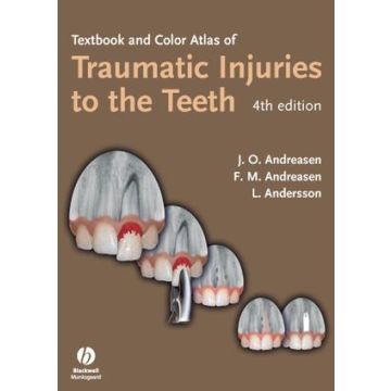 Textbook and Color Atlas of Traumatic Injuries to the Teeth, 4ed.  Andreasen Jens O.; Andreasen Frances M.; Andersson Lars  Wiley - Blackwell  9781405129541