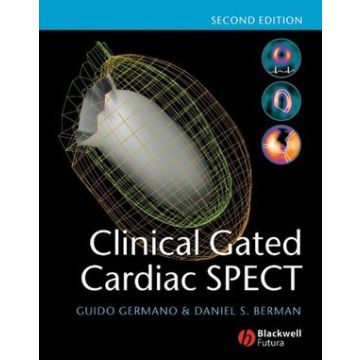 Clinical Gated Cardiac SPECT, 2ed.  Germano Guido; Berman Daniel S.  Wiley - Blackwell  9781405131551