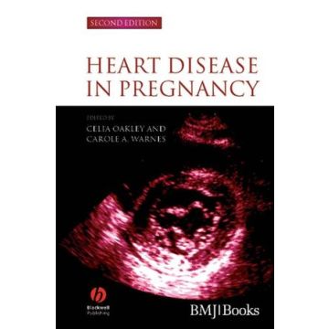 Heart Disease in Pregnancy, 2ed.  Oakley Celia; Warnes Carole A.  Wiley - Blackwell  9781405134880
