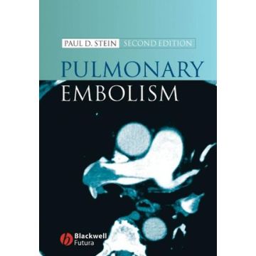 Pulmonary Embolism, 2ed.  Stein Paul  Wiley - Blackwell  9781405138079