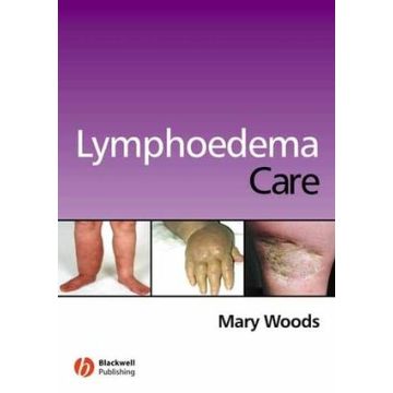 Lymphoedema Care  Woods Mary Elizabeth  Wiley - Blackwell  9781405146289