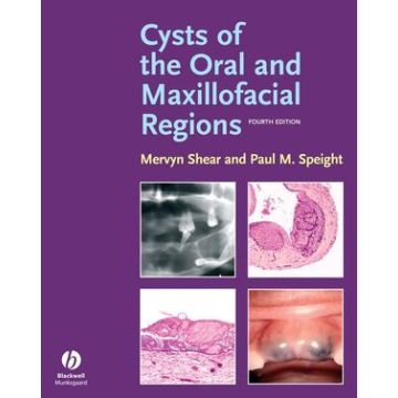 Cysts of the Oral and Maxillofacial Regions, 4ed.  Shear Mervyn; Speight Paul  Wiley - Blackwell  9781405149372