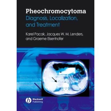 Pheochromocytoma: Diagnosis, Localization, and Treatment  Pacak Karel; Eisenhofer Graeme; Lenders Jacques  Wiley - Blackwell  9781405149501