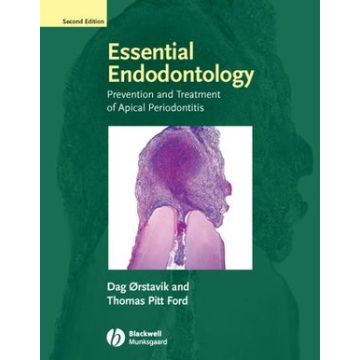 Essential Endodontology: Prevention and Treatment of Apical Periodontitis, 2ed.  Orstavik Dag; Ford Thomas Pitt  Wiley - Blackwell  9781405149761