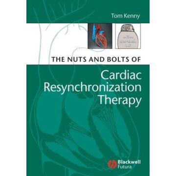 The Nuts and Bolts of Cardiac Resynchronization Therapy  Kenny Tom  Wiley - Blackwell  9781405153720