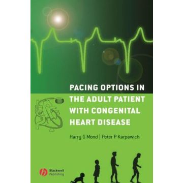Pacing Options in the Adult Patient with Congenital Heart Disease  Mond Harry G.; Karpawich Peter P.  Wiley - Blackwell  9781405155694