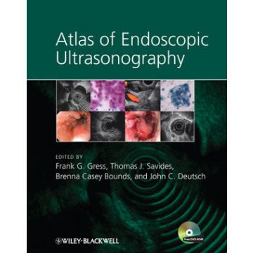 Atlas of Endoscopic Ultrasonography  Gress Frank; Savides Thomas; Bounds Brenna C.; Deutsch John C.  Wiley - Blackwell  9781405157216