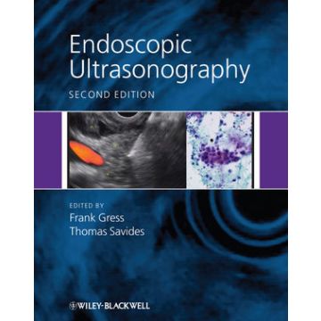 Endoscopic Ultrasonography, 2ed.  Gress Frank; Savides Thomas  Wiley - Blackwell  9781405157223