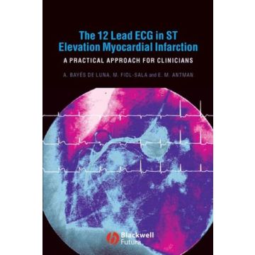The 12 Lead ECG in ST Elevation Myocardial Infarction: A Practical Approcah for Clinicians  Bayes de Luna Antoni; Fiol-Sala Miquel; Antman Elliot M.  Wiley - Blackwell  9781405157865
