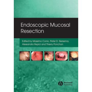 Endoscopic Mucosal Resection  Conio Massimo; Siersema Pieter; Repici Alessandro; Ponchon Thierry  Wiley - Blackwell  9781405158855