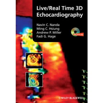 Live/Real Time 3D Echocardiography  Nanda Navin; Hsiung Ming Chon; Miller Andrew P.; Hage Fadi G.  Wiley - Blackwell  9781405161411