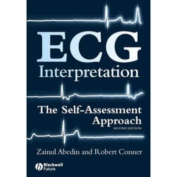 ECG Interpretation: The Self-Assessment Approach, 2ed.  Abedin Zainul; Conner Robert  Wiley - Blackwell  9781405167499