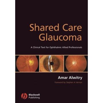 Shared Care Glaucoma  Alwitry Amar; Vernon Stephen  Wiley - Blackwell  9781405168007
