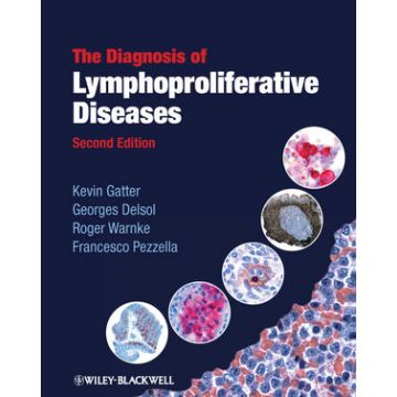 The Diagnosis of Lymphoproliferative Diseases, 2ed.  Gatter Kevin; Delsol Georges; Warnke Roger; Pezzella Francesco  Wiley - Blackwell  9781405170147