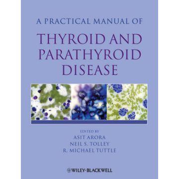 Practical Manual of Thyroid and Parathyroid Disease  Arora Asit; Tolley Neil; Tuttle R. Michael  Wiley - Blackwell  9781405170345