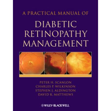 A Practical Manual of Diabetic Retinopathy Management  Scanlon Peter; Aldington Stephen; Wilkinson Charles; Matthews David  Wiley - Blackwell  9781405170352