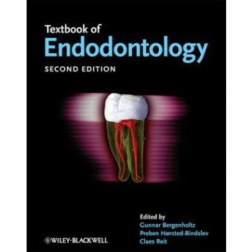 Textbook of Endodontology, 2ed.  Bergenholtz Gunnar; Hørsted-Bindslev Preben; Reit Claes  Wiley - Blackwell  9781405170956