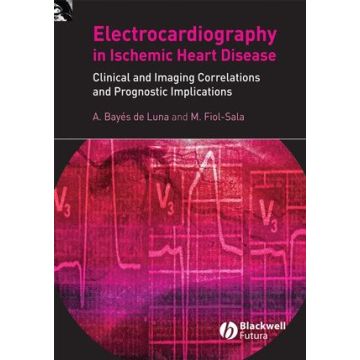 Electrocardiography in Ischemic Heart Disease: Clinical and Imaging Correlations and Prognostic Implications  Bayes de Luna Antoni; Fiol-Sala Miquel  Wiley - Blackwell  9781405173629