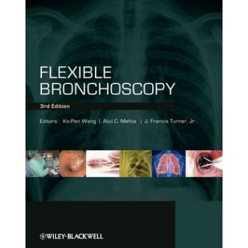 Flexible Bronchoscopy, 3ed.  Wang Ko-Pen; Mehta Atul C.; Turner J. Francis  Wiley - Blackwell  9781405175876