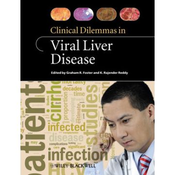 Clinical Dilemmas in Viral Liver Disease  Foster Graham; Reddy K. Rajender  Wiley - Blackwell  9781405179058
