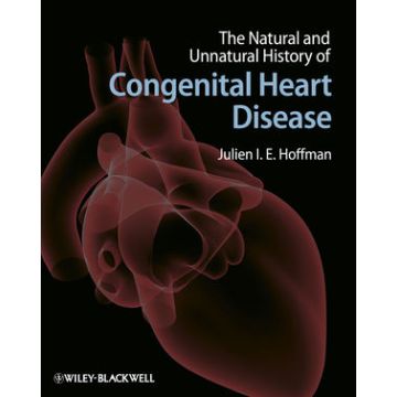 The Natural and Unnatural History of Congenital Heart Disease  Hoffman Julien I. E.  Wiley - Blackwell  9781405179270