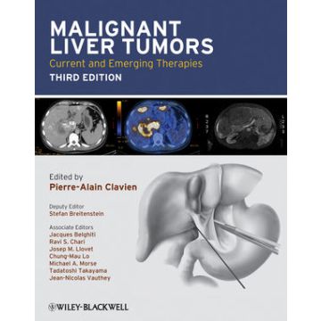 Malignant Liver Tumors: Current and Emerging Therapies, 3ed.  AA.VV.  Wiley - Blackwell  9781405179768