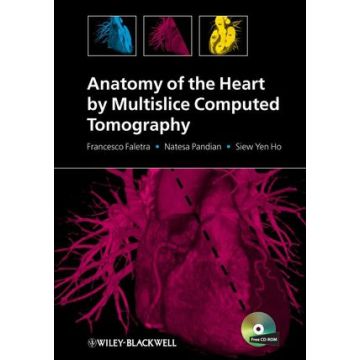 Anatomy of the Heart by Multislice Computed Tomography  Faletra Francesco; Pandian Natesa; Ho Siew Yen  Wiley - Blackwell  9781405180559