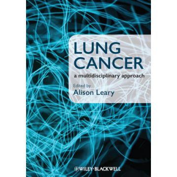 Lung Cancer: A Multidisciplinary Approach  Leary Alison  Wiley - Blackwell  9781405180757