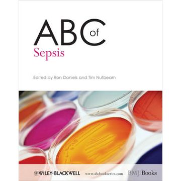 ABC of Sepsis  Daniels Ron; Nutbeam Tim  Wiley - Blackwell  9781405181945