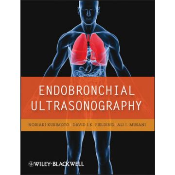 Endobronchial Ultrasonography  Kurimoto Noriaki; Fielding David; Musani Ali  Wiley - Blackwell  9781405182720